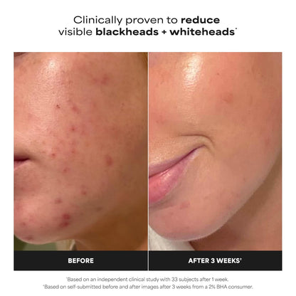 Paula'S Choice SKIN PERFECTING 2% BHA Liquid Leave-On Exfoliant