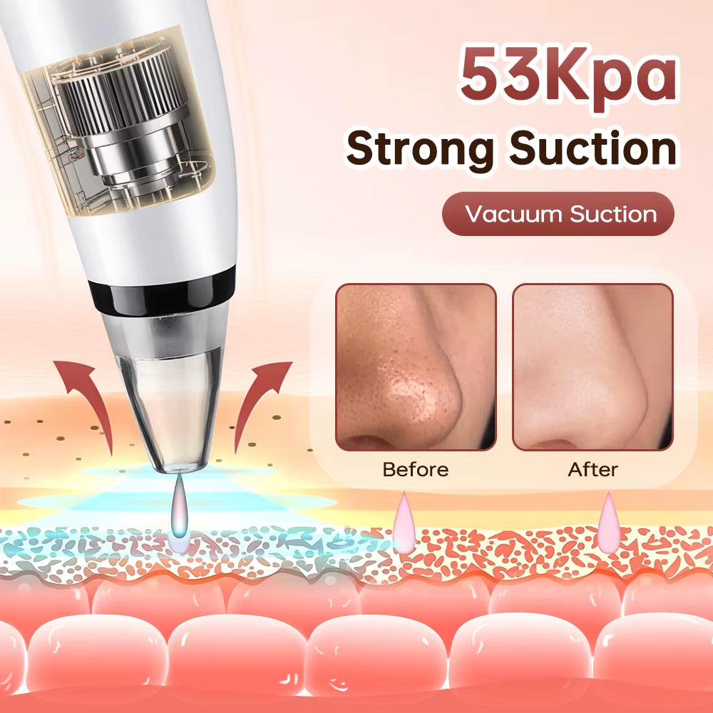 Blackhead Remover Facial Pore Cleaner 3 Suction Power Electric Pimple Acne Extractor Tool Face & Nose Whiteheads Vacuum Removal