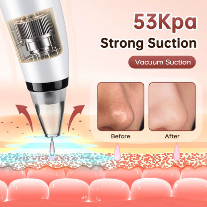 Blackhead Remover Facial Pore Cleaner 3 Suction Power Electric Pimple Acne Extractor Tool Face & Nose Whiteheads Vacuum Removal