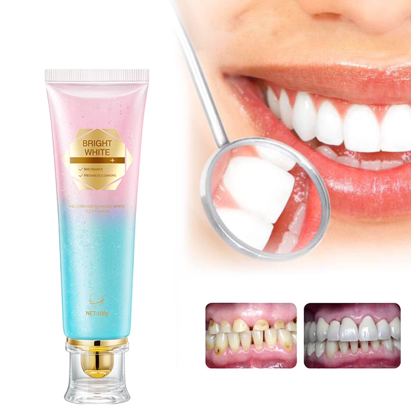 2PCS Niacinamide Whitening Toothpaste,Body Accel Niacinamide Whitening Toothpaste, Niacinamide Toothpaste, Teeth Whitening Toothpaste, Stain Removal and Whitening